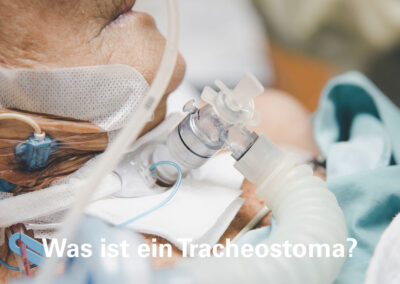 was ist ein tracheostoma?