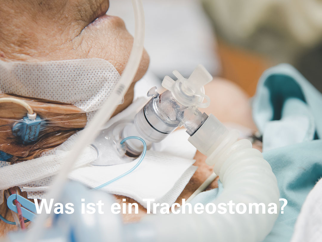 was-ist-ein-tracheostoma?